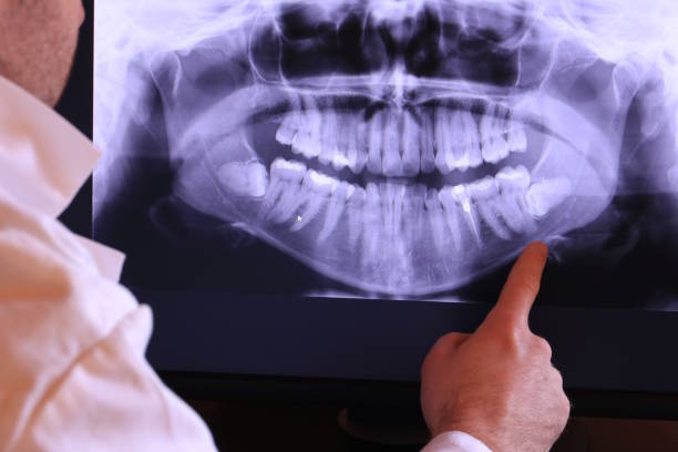 Best Pediatric Emergency Dentist in Navy Yard City, WA