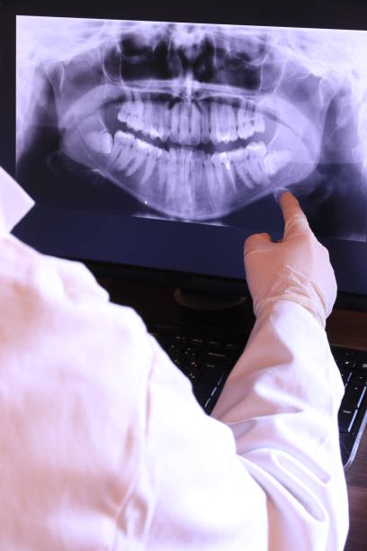 Best Weekend Emergency Dentist in Navy Yard City, WA