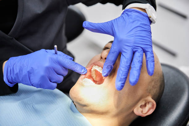 Best Emergency Tooth Extraction in Navy Yard City, WA